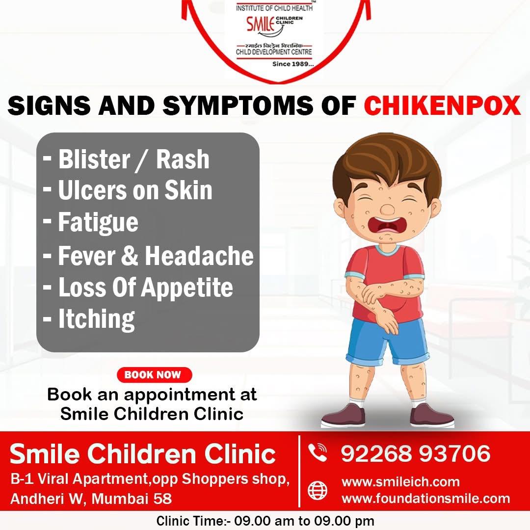 Monkeypox In Children in Andheri Juhu, Vile parle Mumbai Monkeypox In Children in Jogeshwari, Andheri Mumbai